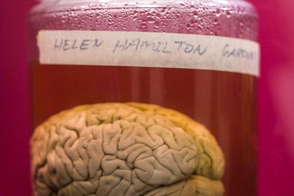 Brain of Helen Hamilton Gardener