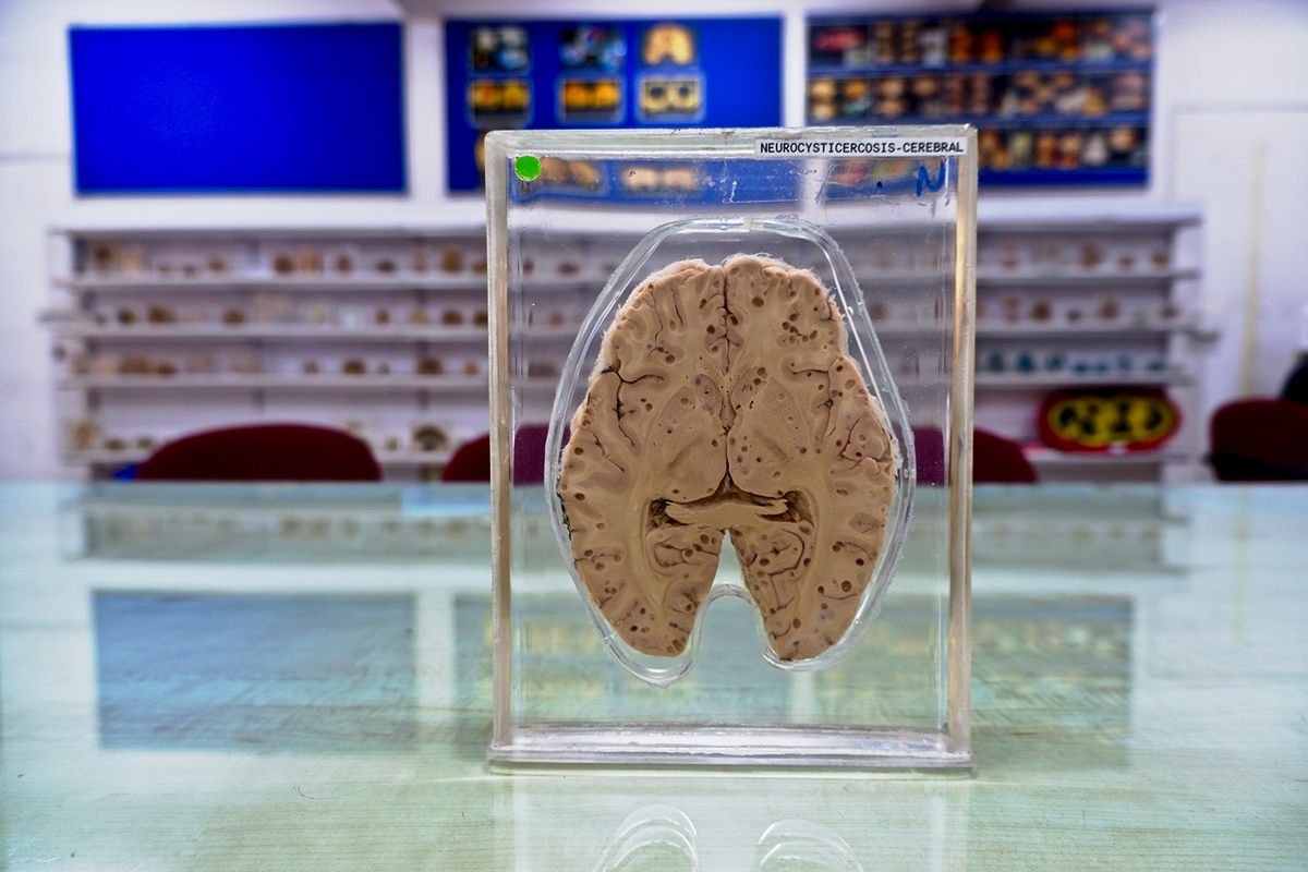 Visitors Can Touch Human Brains at This Indian Neuroscience Institute -  Atlas Obscura