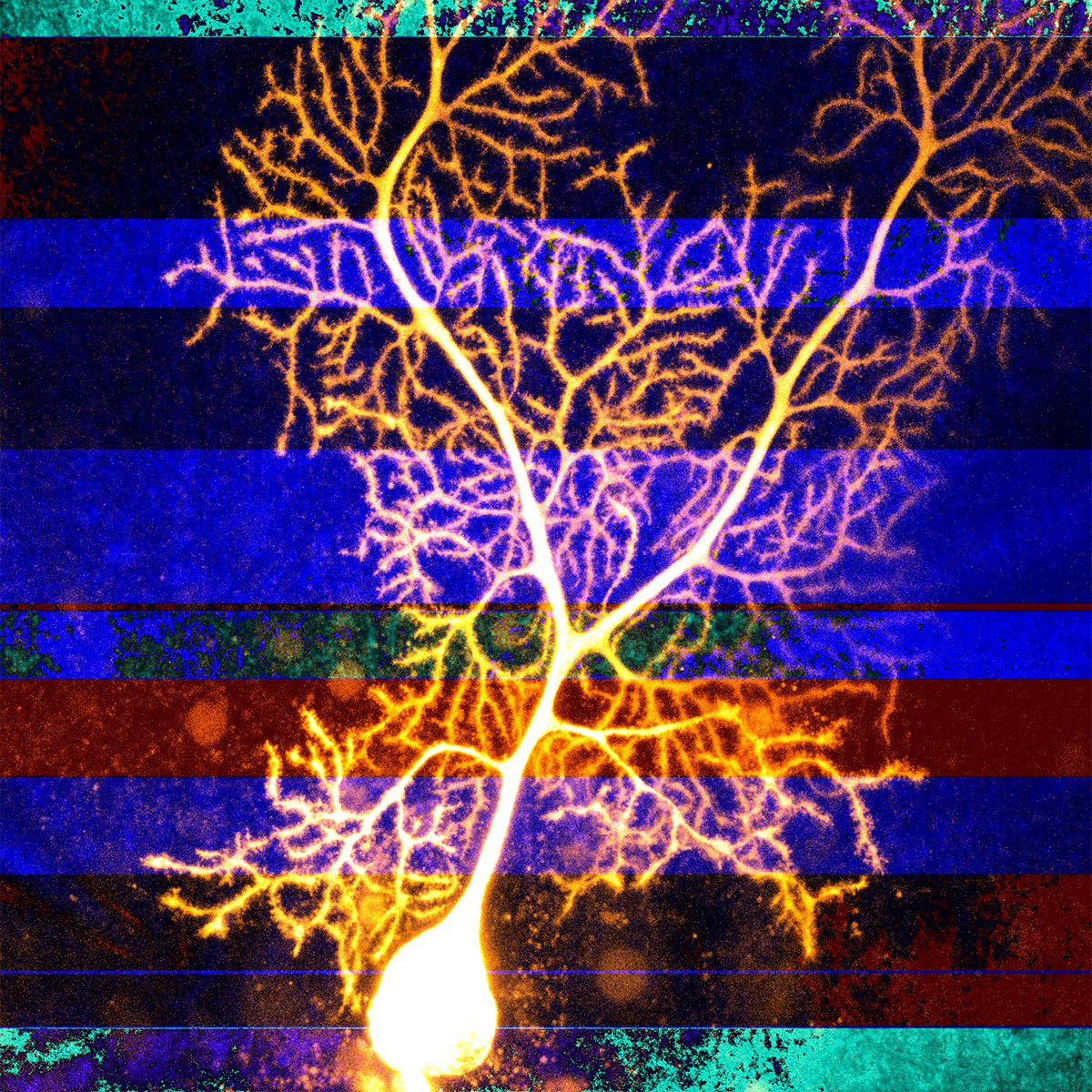 <em>Animon</em>, Honorable Mention 2017. A Purkinje neuron (found in the cerebellum) turns gold after being loaded with fluorescent dye.