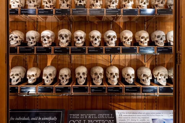 The Hyrtl Skull Collection isn't just medical history. Scientists continue to study the bones today.