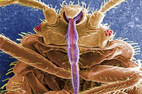 Why Doctors Once Treated Fevers and Hysteria With Mashed-Up Bedbugs