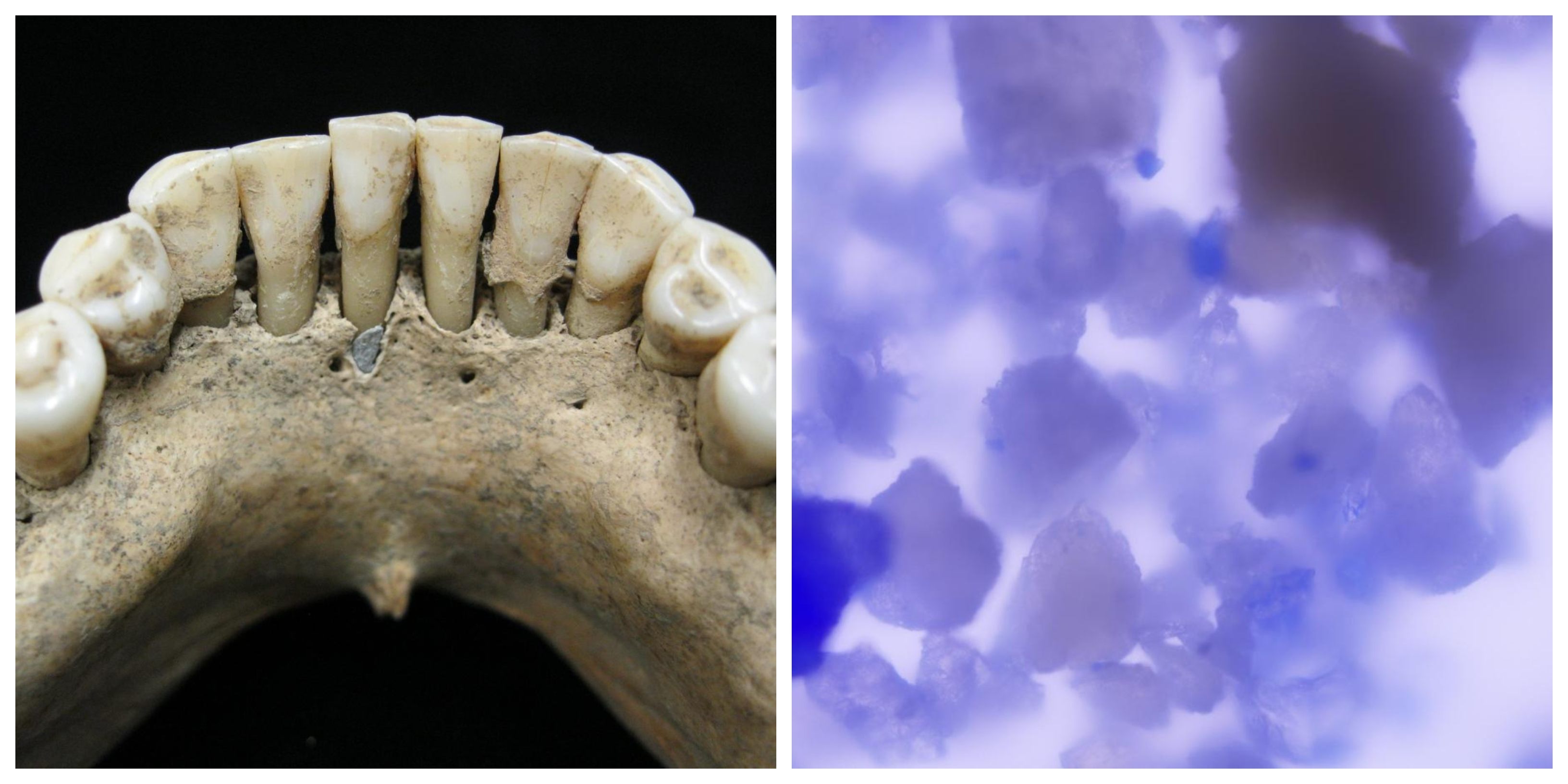 The teeth looked unremarkable at first glance, but blue pigments jumped out under the microscope.