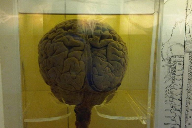 The Inept Story Behind 100 Missing Brains at the University of Texas -  Atlas Obscura