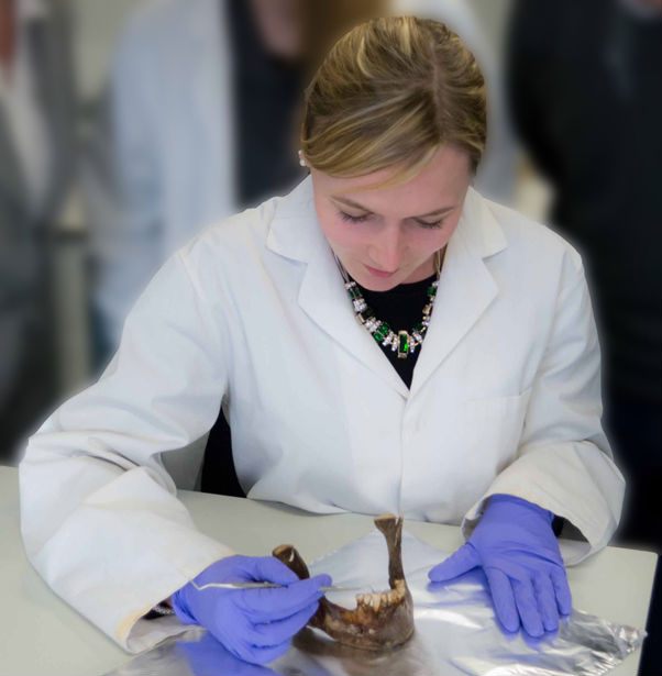 Dr. Charlton in the process of sampling dental calculus from a set of teeth.