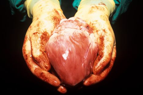 Only a select number of patients can experience holding their own heart in their hands.