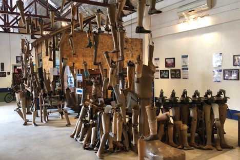 Formerly used prosthetic limbs are everywhere in the visitor centre.