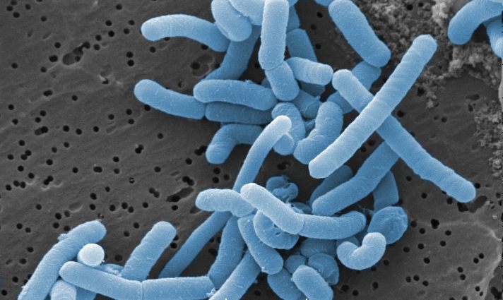 Many kinds of bacteria both harmful and helpful can cause milk to curdle, such as this <em>Lacticaseibacillus paracasei.</em>