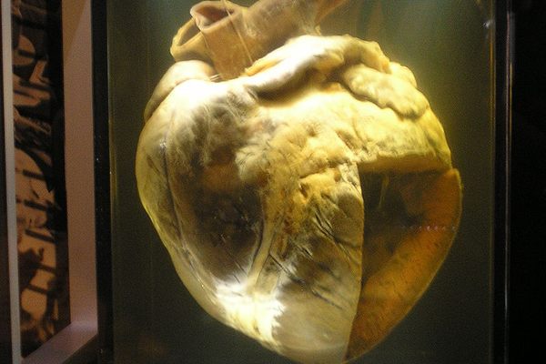 Phar Lap's heart at the National Museum of Australia.