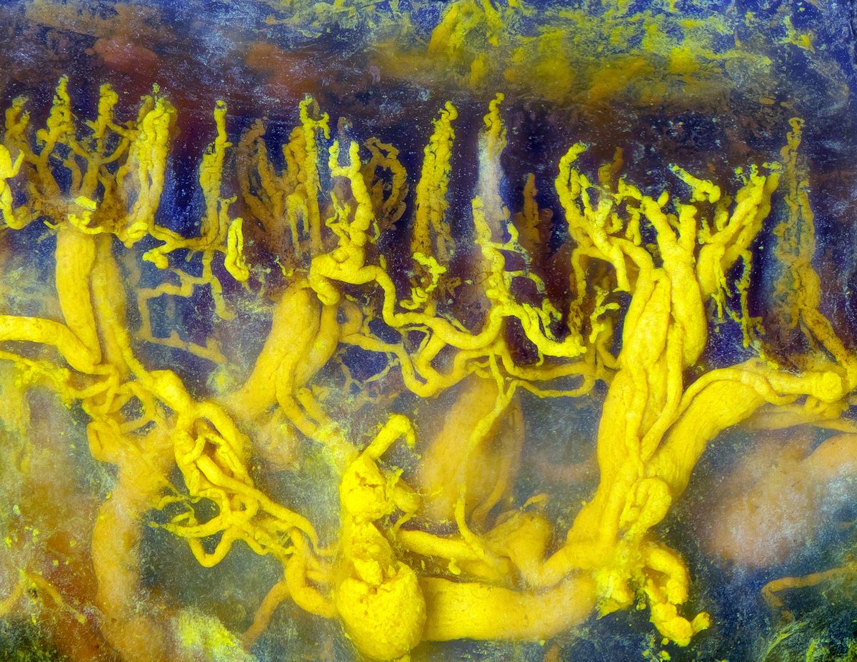 Human tongue blood vessels injected with lead chromate (Honorable Mention).