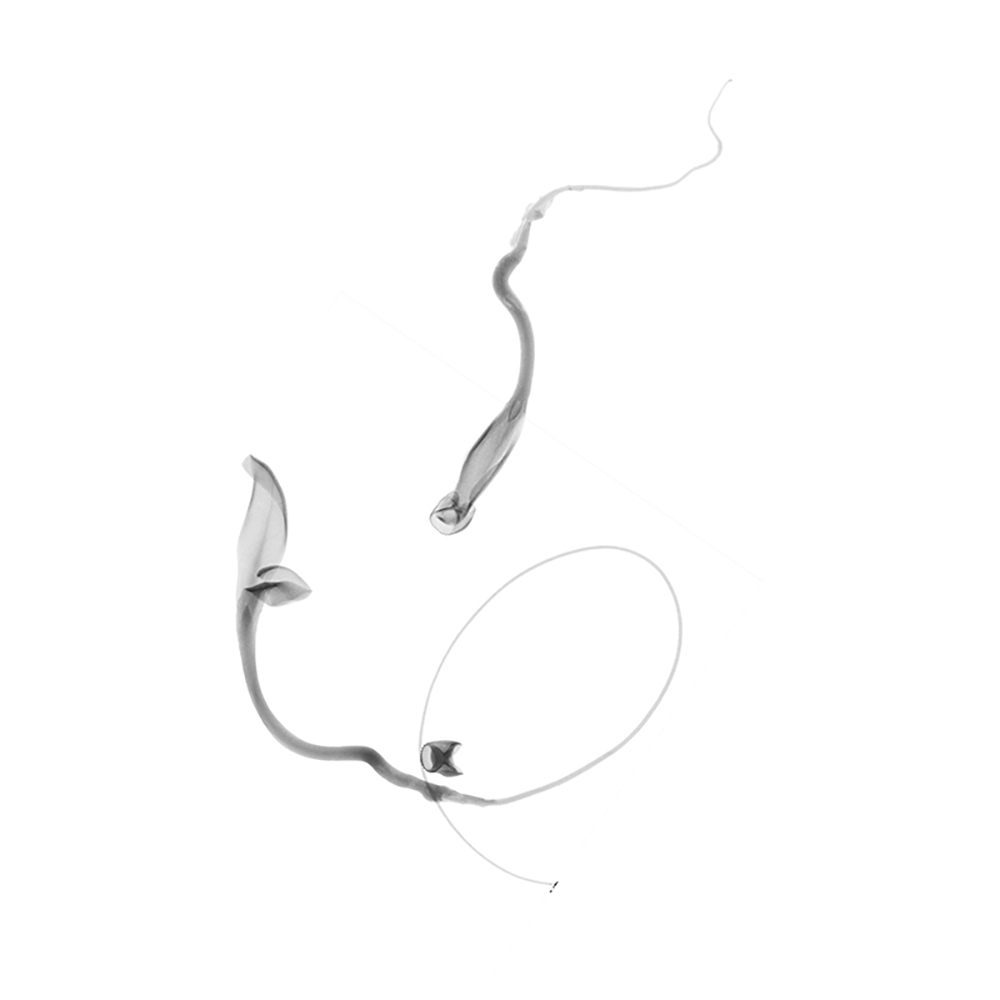 In the x-ray view, this pair of wild seedlings looks almost like two swimming sperm.