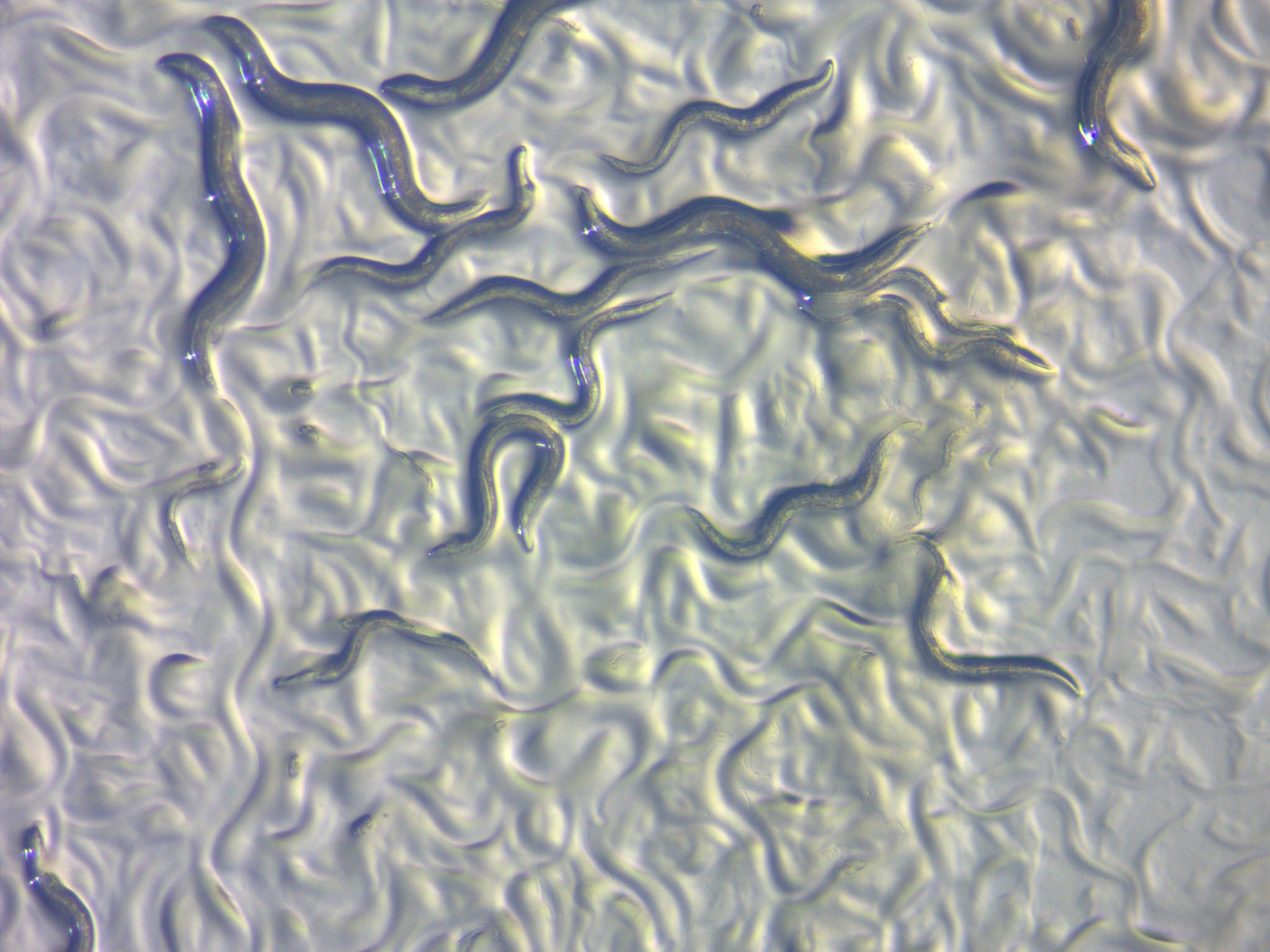 <em>C. elegans</em>, a flatworm, is used as a model organism in biology labs. It has just 29 different types of cells.