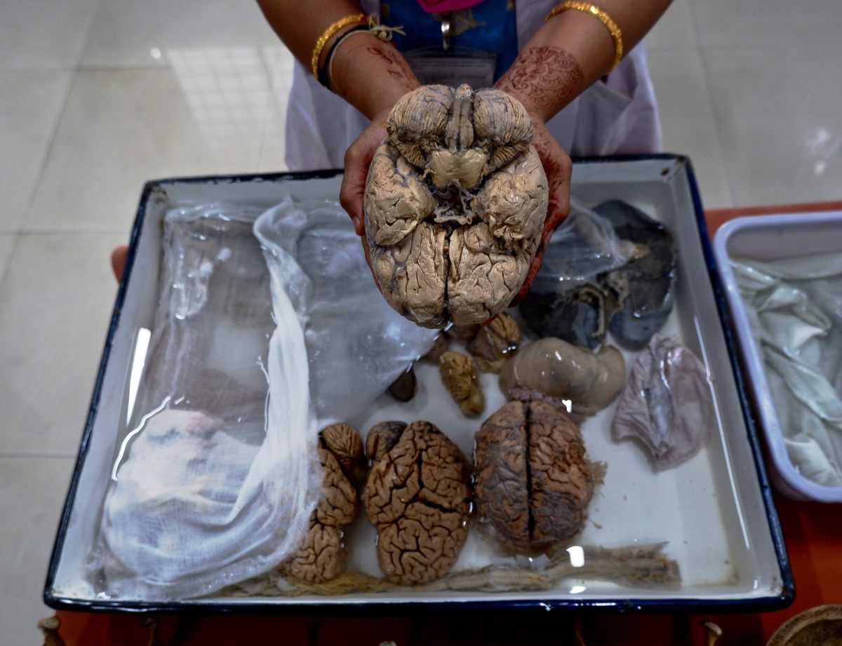 Visitors Can Touch Human Brains at This Indian Neuroscience Institute -  Atlas Obscura