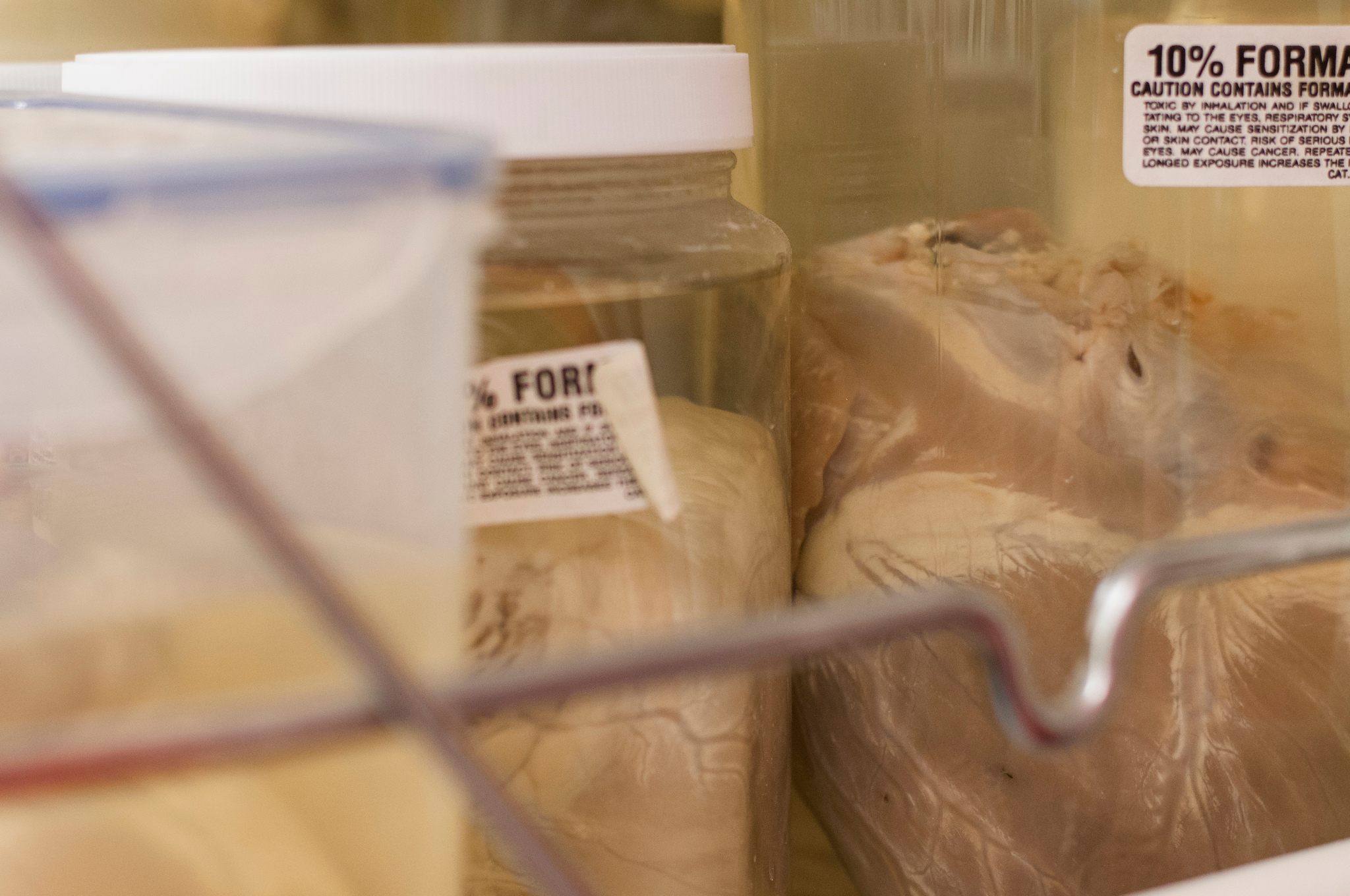 Hearts preserved in jars. Many institutions don't have the space to store specimens.