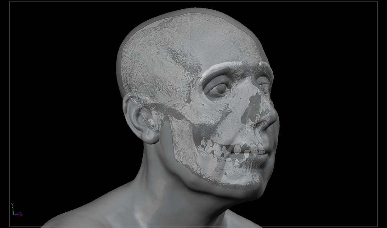 The skull of Lilias Adie, an accused witch, is superimposed over her face in this 2018 reconstruction by forensic artist Christopher Rynn.
