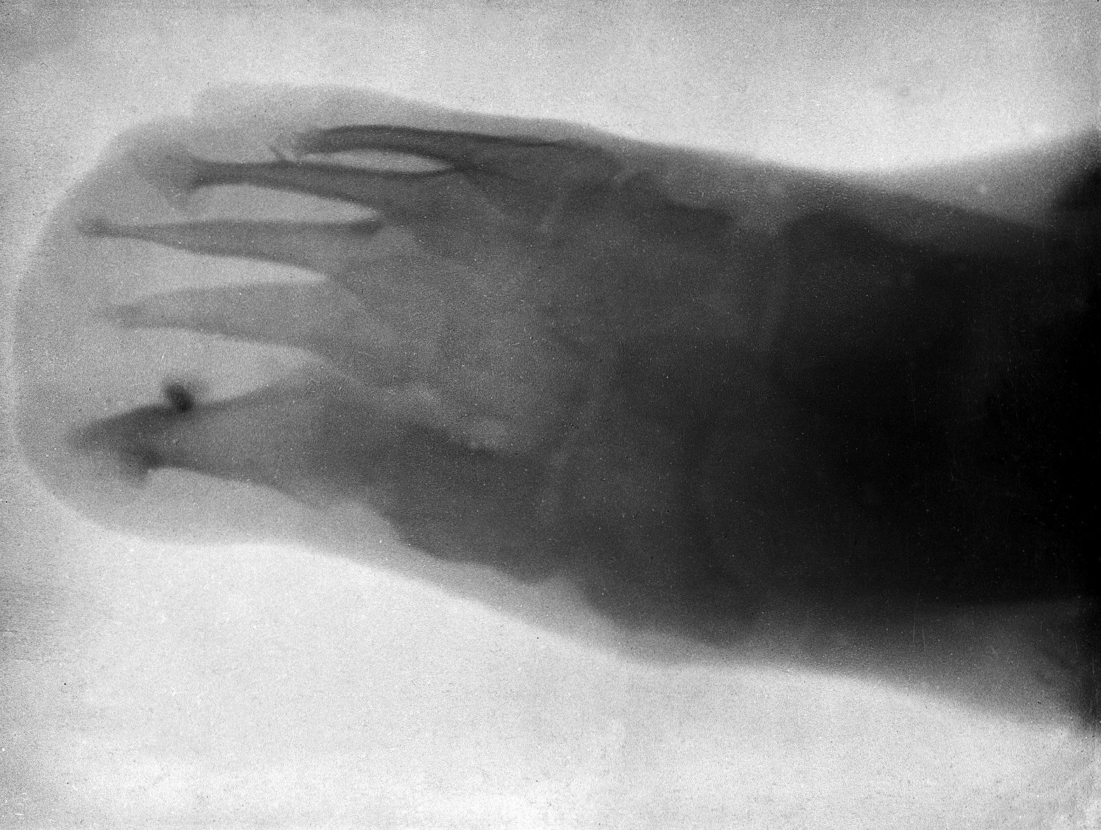 first x ray machine roentgen