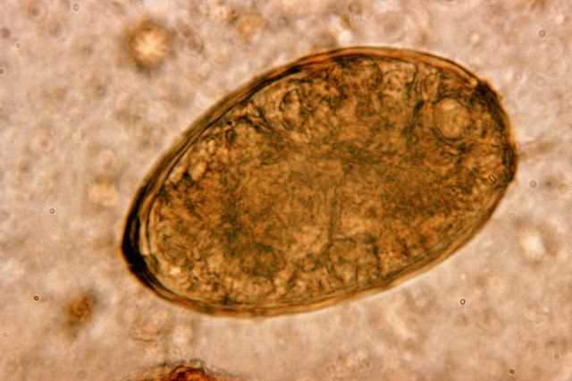 The egg of one species of Paragonimus.