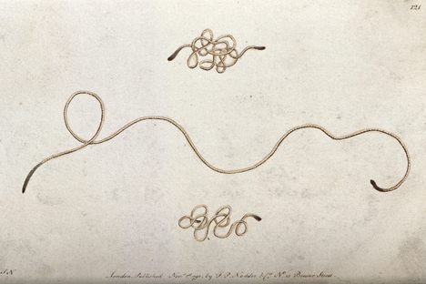 A nemotode worm like the ones found in the Siberian permafrost, drawn in 1792.