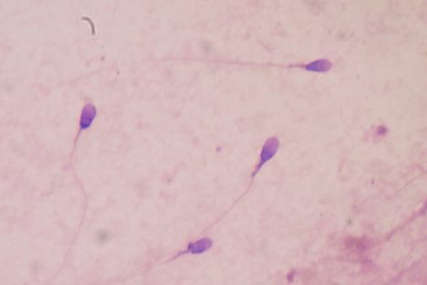 There's a Big Sperm Shortage in New Zealand