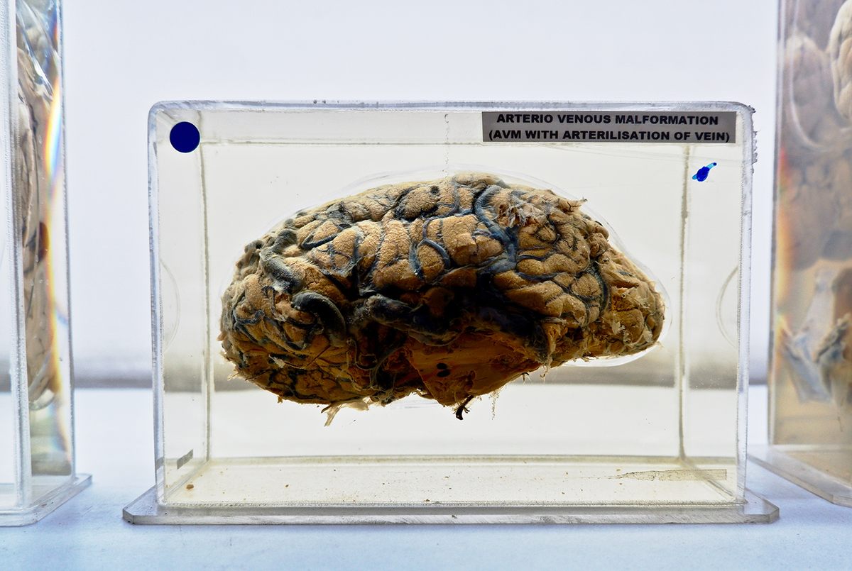 Visitors Can Touch Human Brains at This Indian Neuroscience