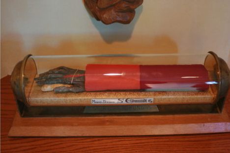 Severed Arm of Saint Edmund