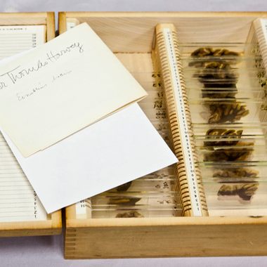 Einstein's Brain Slides