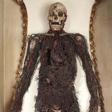 An anatomical model.