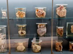 Anatomical pathology collection