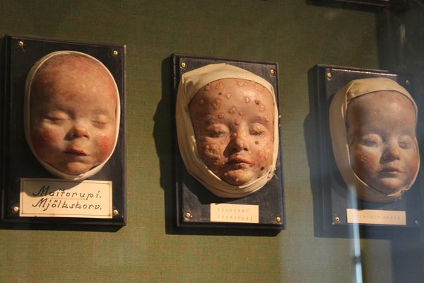 Infant Wax Moulage