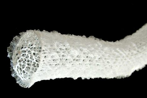 The silicon skeleton of a glass sponge.