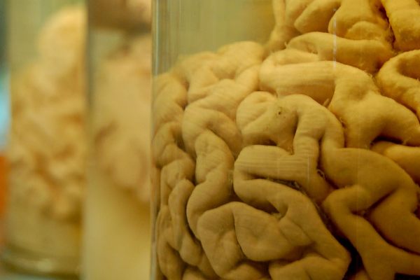 Brains preserved in jars.