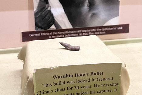 The bullet that was lodged in Itote for 34 years.