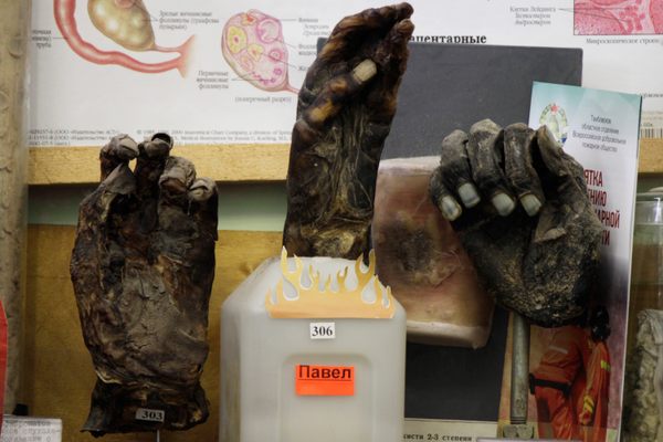 Do you want your hands to come out looking like these?