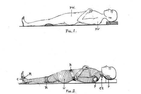 The Modest Victorian Proposal to Electroplate Corpses Into Beautiful Statues