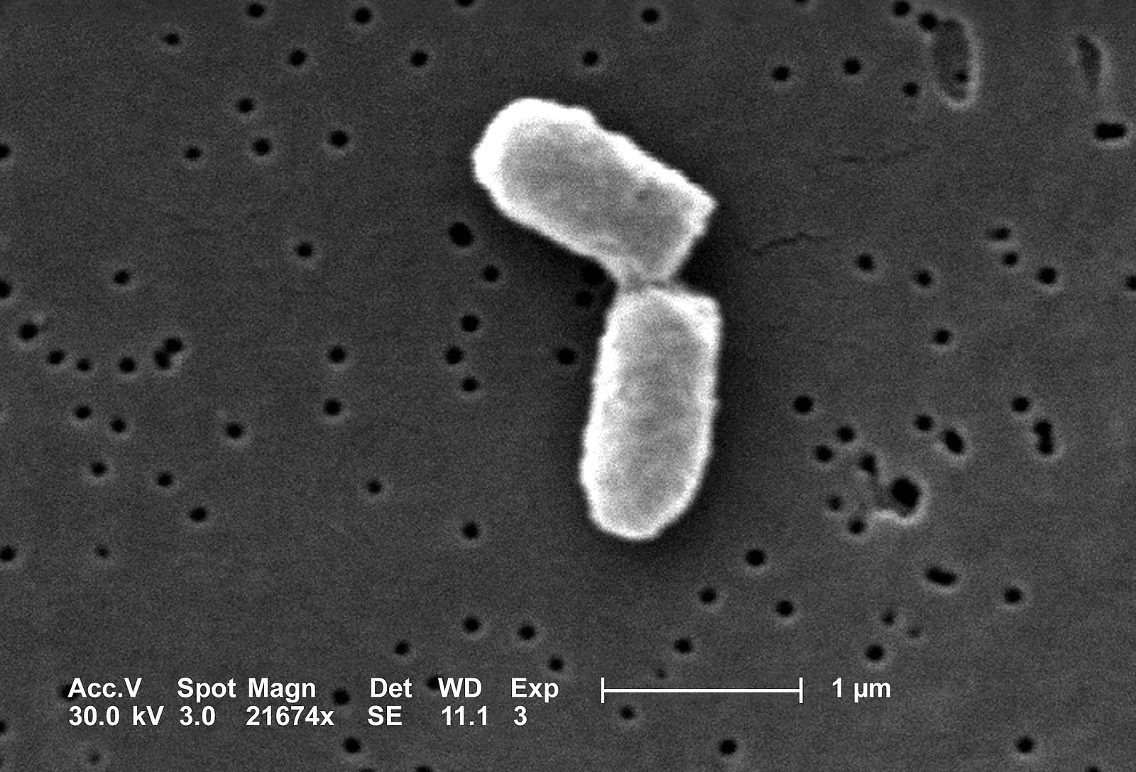 An E. coli mother cell, dividing into two almost-identical daughters.