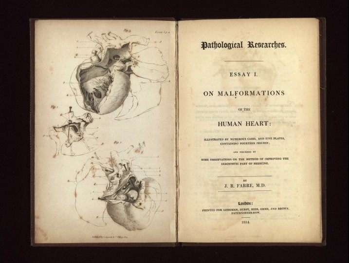 J.R. Farre's "On malformations of the human heart," an example of heart research in Beethoven's time.
