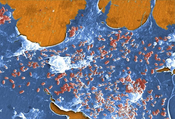 A biofilm with bacteria and amoeba found in untreated stream water.