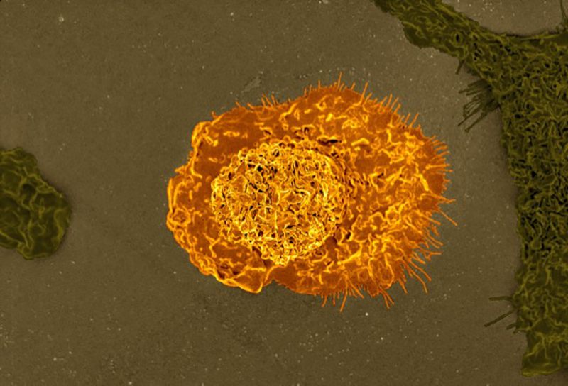 And on a small scale (scanning electron micrograph of a macrophage).
