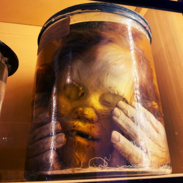 Museum of Pathological Anatomy