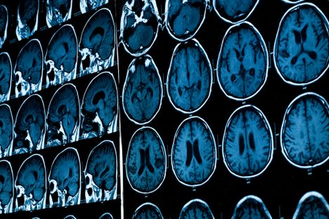 Meet the Brain Banker Who Keeps Thousands of Brains In His Lab In the Bronx