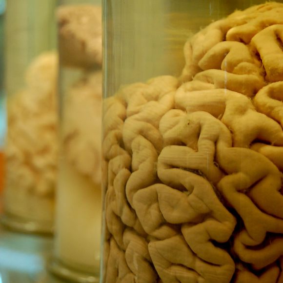 Visitors Can Touch Human Brains at This Indian Neuroscience Institute -  Atlas Obscura