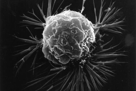 The Protein That Might Be Cancer's Undoing