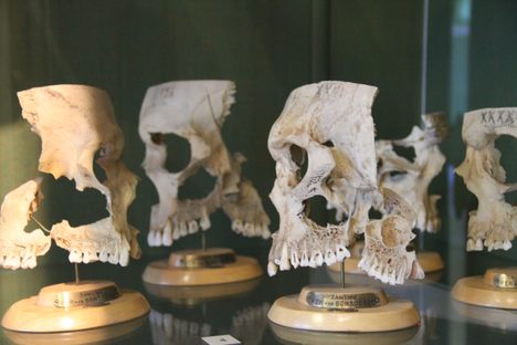 Skull Cross-sections