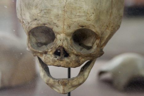 Notes from the Field: Congdon Anatomical Museum