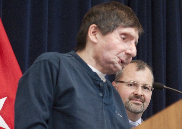 (2012) Face transplant recipient Jim Maki speaks to an audience at Natick Soldier Systems Center as Dr. Bohdan Pomahac of Brigham and Women's Hospital in Boston listens.