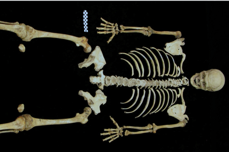 The complete Odd Fellows skeleton studied by Alapisco.
