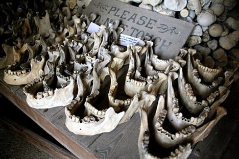 Trepanation and His Dark Materials