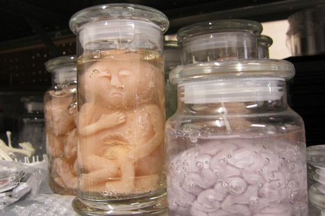 Conjoined fetus and brain-in-jar candles