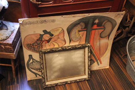 Framed X-ray and anatomical chart