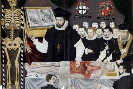 A 16th-century anatomical lecture in London.