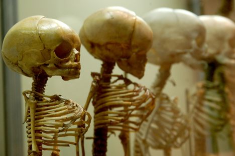 Morbid Monday: The Wandering Dead